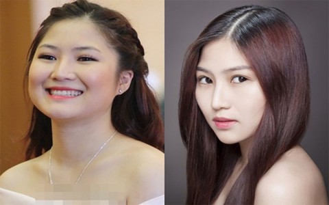 Có nên sửa mũi theo lời… thầy tướng số?
