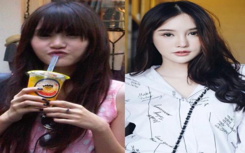 Há hốc mồm vì loạt ảnh phẫu thuật thẩm mỹ của Hot Girl Thái Lan: MÊ CHỮ Ê... KÉO DÀI