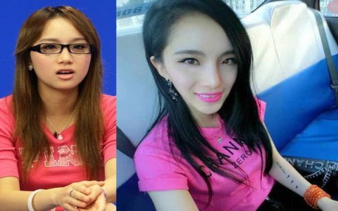 Khi “Phẫu thuật thẩm mỹ” trở thành “Thảm họa thẩm mỹ”