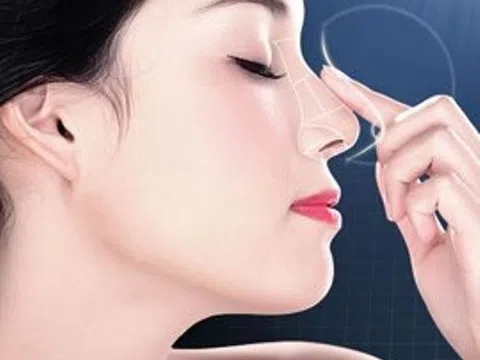 Sửa mũi có đau không?