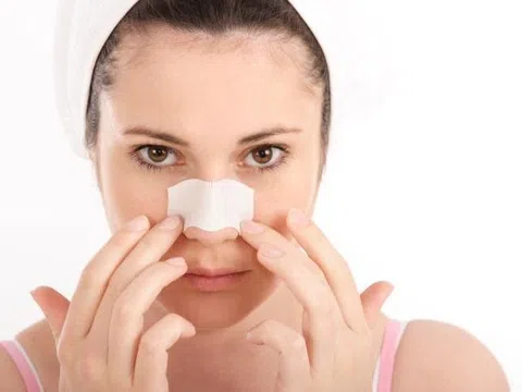 Hỏi - đáp: Nâng mũi sau bao lâu có thể tháo nẹp?