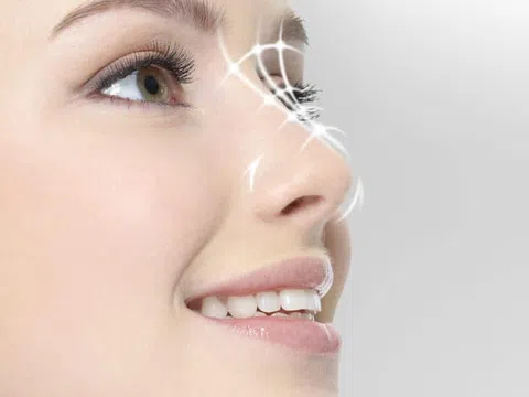 Kỹ thuật fascia sụn thái hạt lựu được cập nhật để nâng cao mặt lưng trong phẫu thuật nâng mũi