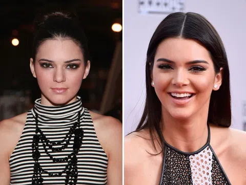 Siêu mẫu lừng danh Kendall Jenner từng "chỉnh sửa nhan sắc" như thế nào?